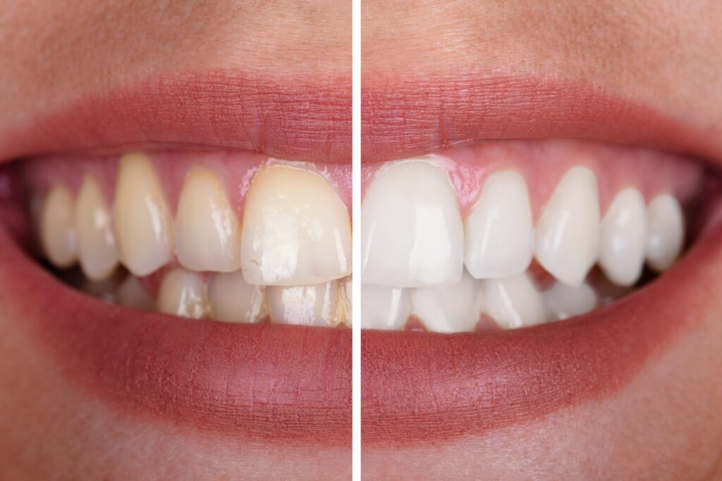 Dentist in Izmir