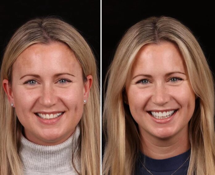 Best Top 10 Dentist in Bodrum