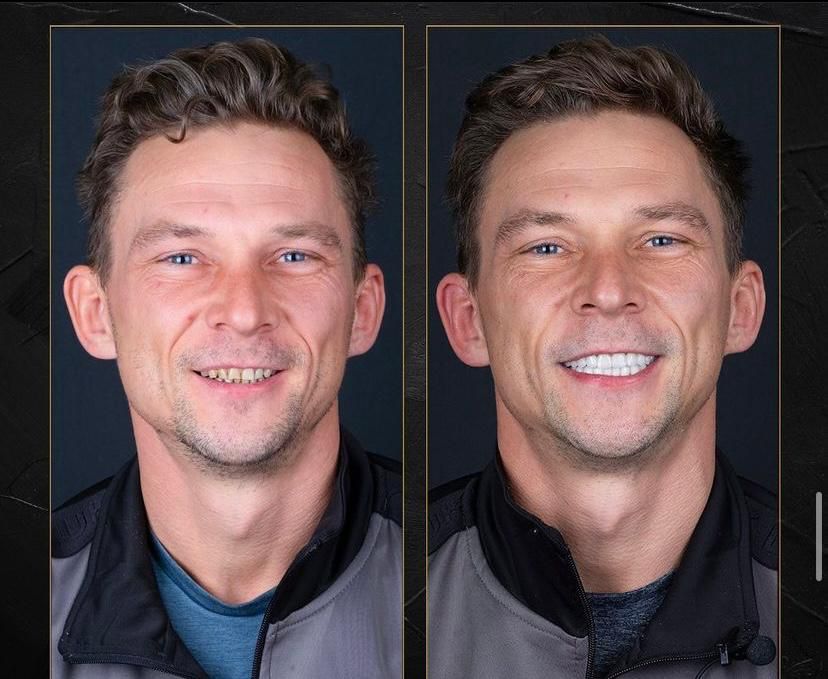 Best Top 10 Dentist in Bodrum